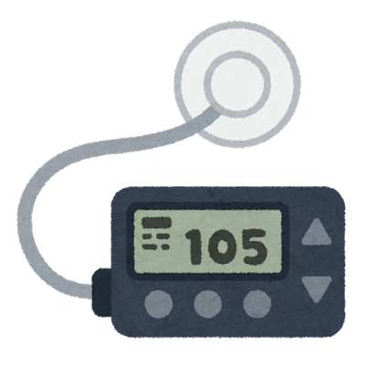 外来インスリンだけでなくインスリンポンプ療法を導入